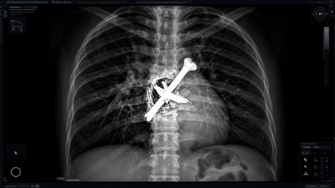Why Dogs Eat Bones: The 2019 Vet Record Study on Fractured Esophagi